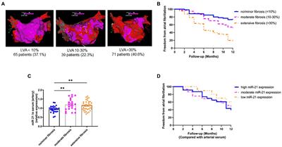 MicroRNA-21 mediated cross-talk between cardiomyocytes and fibroblasts in patients with atrial fibrillation